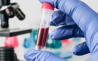 血常规检查的局限性：为什么它不能直接诊断癌症？